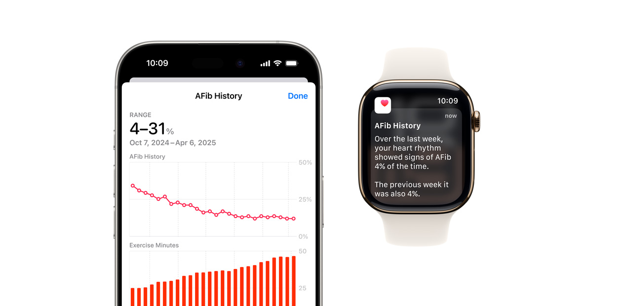 Interface affichant l’app Historique de FA sur iPhone et des notifications sur Apple Watch.