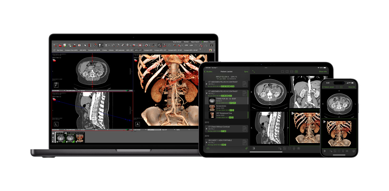 O software exibe o app Visage, usado pelos radiologistas para interpretar grandes arquivos de diagnóstico